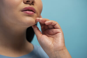Obrzęk naczynioruchowy (angioedema) – przyczyny, objawy i leczenie