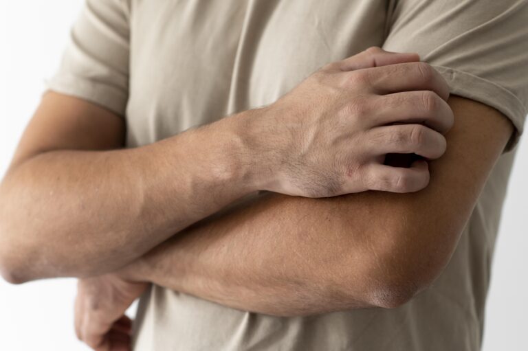 Choroba Fabry’ego – kiedy ból w kończynach zaczyna się w dzieciństwie - okładka